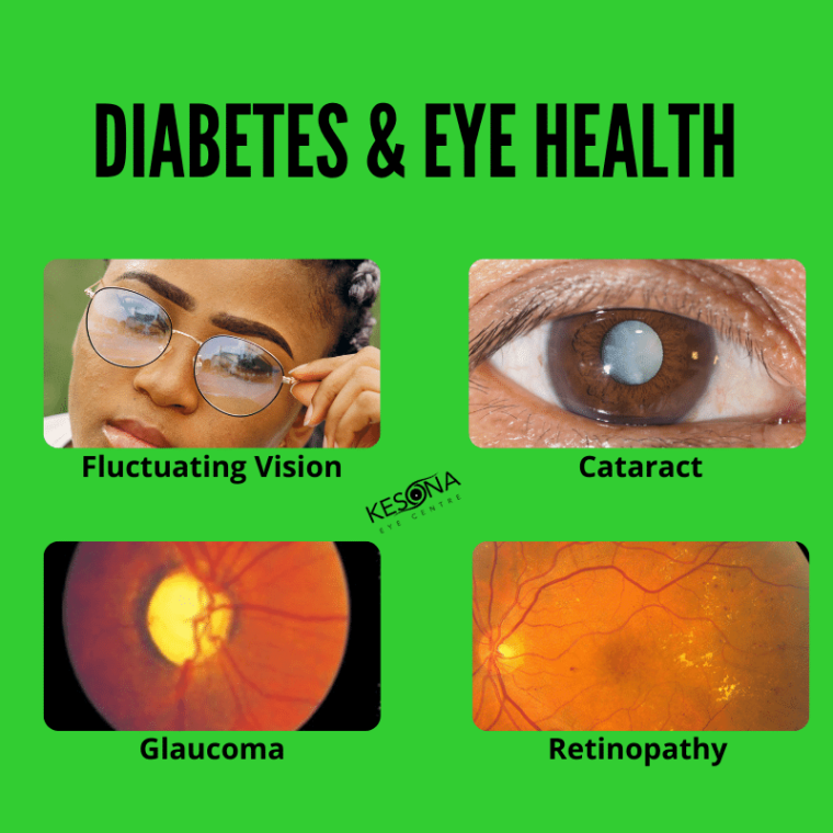 Diabetes Eye Exam Report Form Fill Out And Sign Print vrogue.co